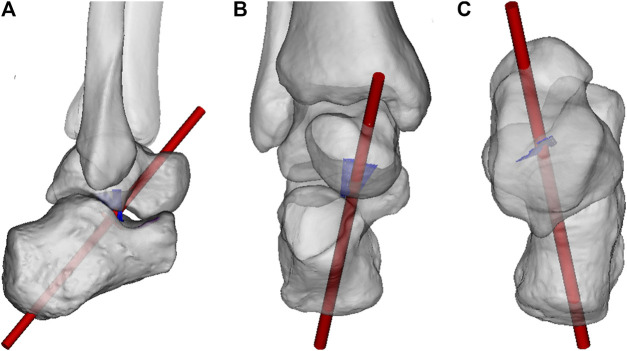 FIGURE 2