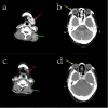 Fig. 1