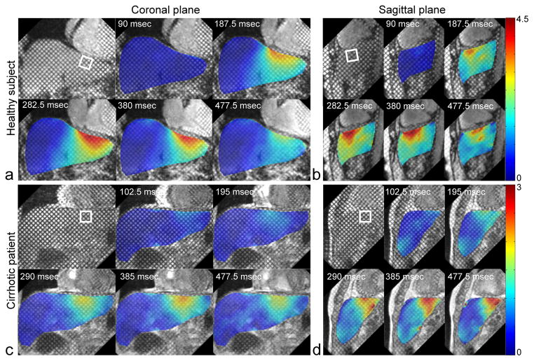 FIG. 3