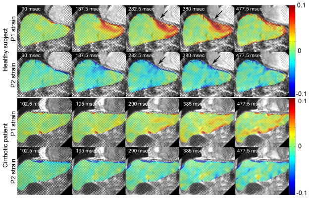 FIG. 4