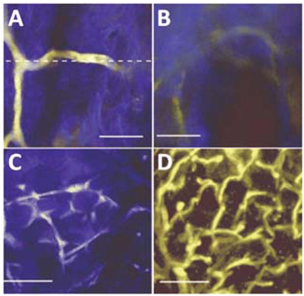 Fig. 13