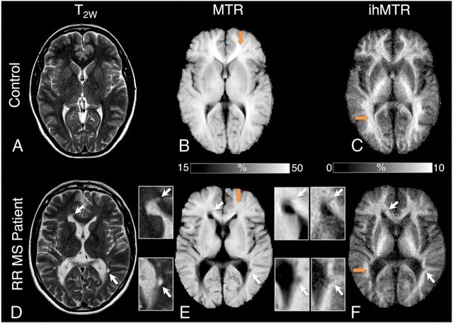 Fig 2.