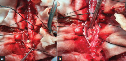 Figure 3: