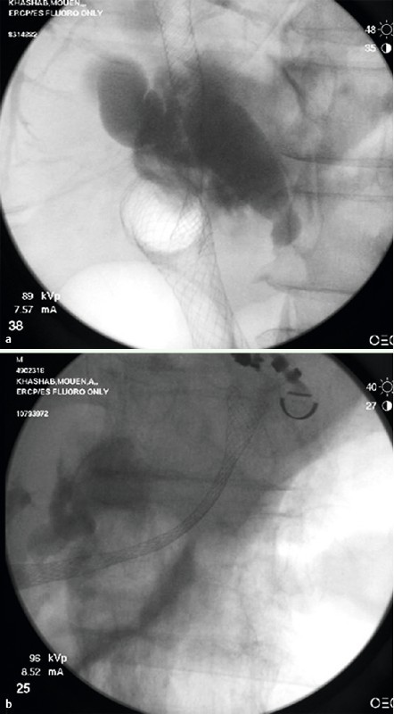 Fig. 1 