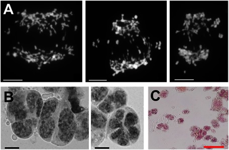 Figure 2. Microsporogenesis and pollen grain of Oncidium “Honey Snow” MF-1. (A) Chromosomal laggard at anaphase I stage during microsporogenesis. The laggard caused some chromatids to separate unequally into daughter cells. (B) Microspore formation showing abnormal types of diads and hexads (right panel), as well as triads and tetrads of various sizes (left panel). Unequal chromatid separation caused the abnormal microspore formation. (C) Pollen grains showing irregular shape, abnormal development of cell shape, and cell content. Acetocarmine staining was not homogenous in pollen cells. Scale indicates 50 µm.