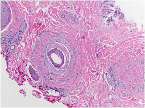 Fig 6