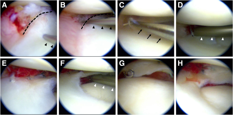 Fig 4