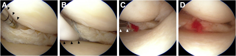 Fig 6