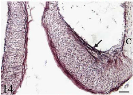 Fig. 14