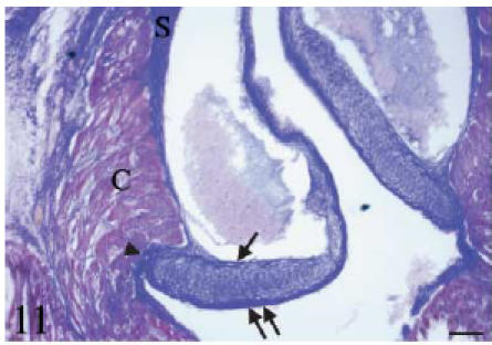 Fig. 11