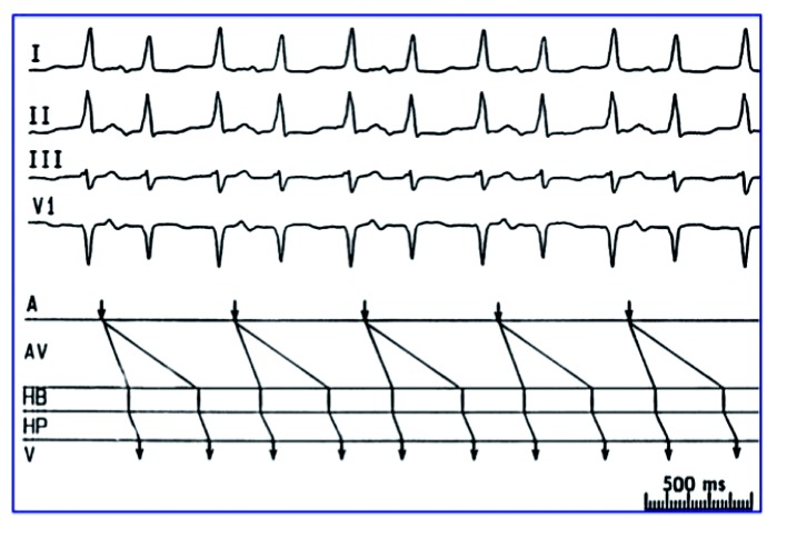 Figure 2: