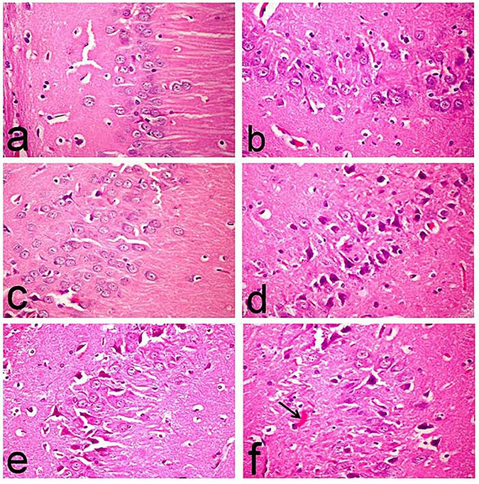 Fig 11