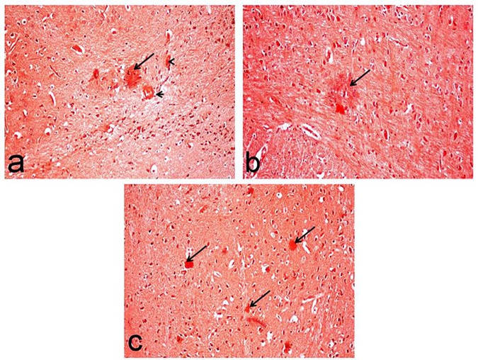 Fig 10