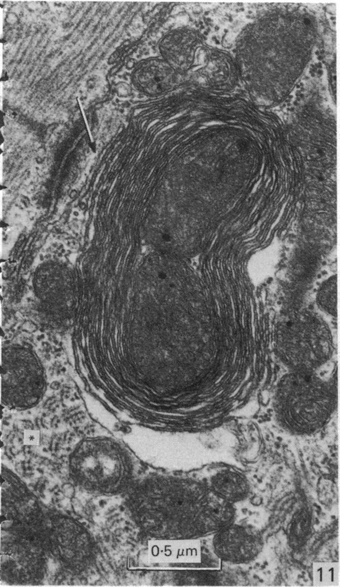 Fig. 11