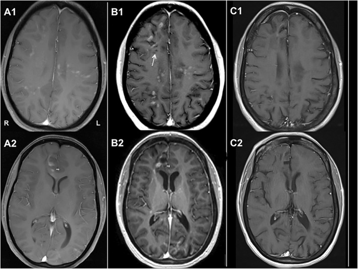 Fig. 2