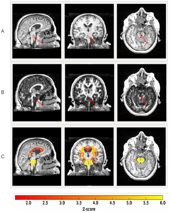 Fig 2