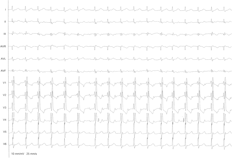 Figure 1