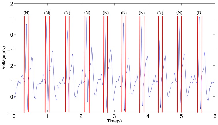 Figure 18.