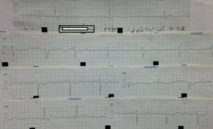 Figure 2