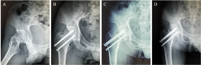 Figure 2