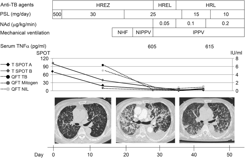 Fig. 1