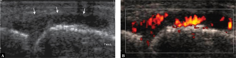 Fig. 14