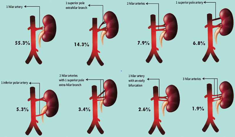 Interventional Radiology in Renal Trauma - PMC