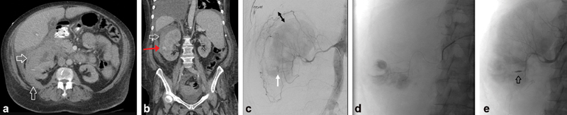 Fig. 9