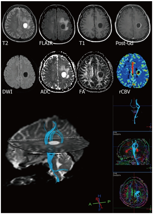 Fig. 9