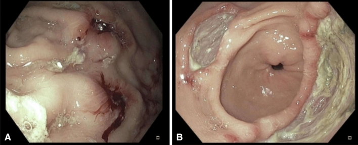 Fig. 1