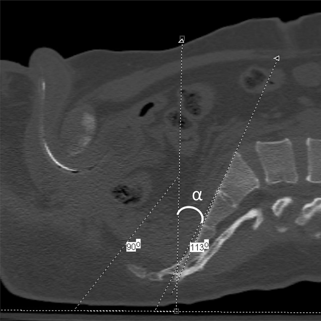 Fig. 2