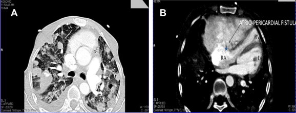 Fig. 3