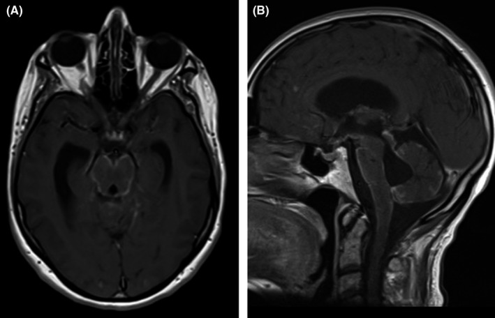 FIGURE 3