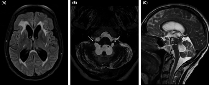 FIGURE 2