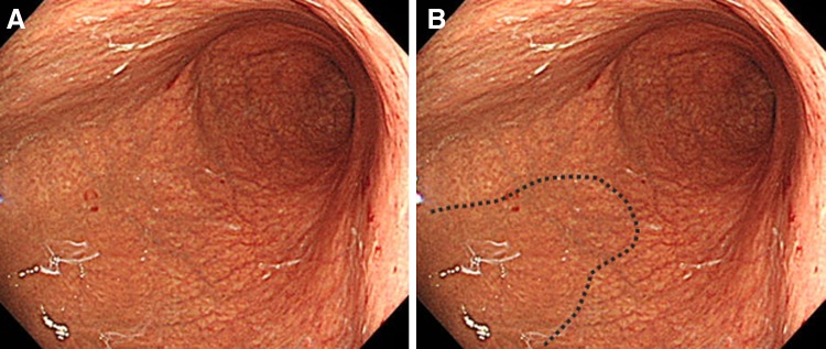 Fig. 3