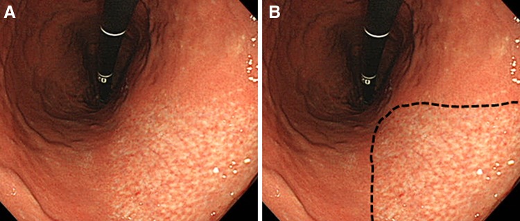 Fig. 1