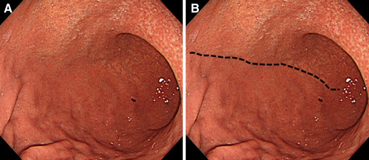 Fig. 2