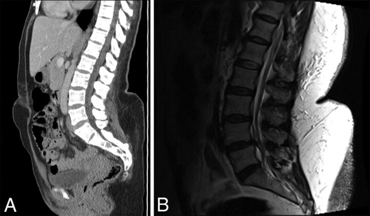 Fig 4.