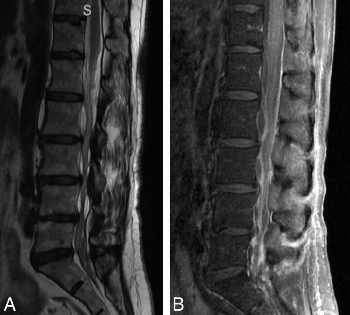 Fig 3.