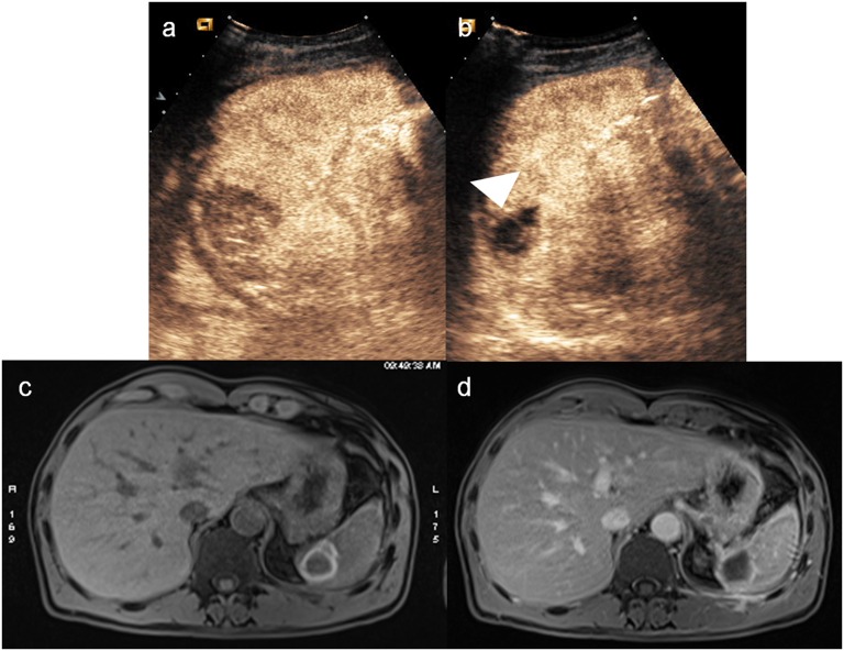 Figure 14.