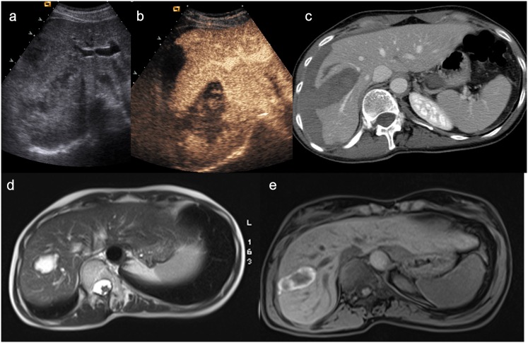 Figure 15.