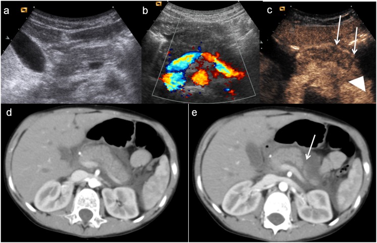 Figure 12.