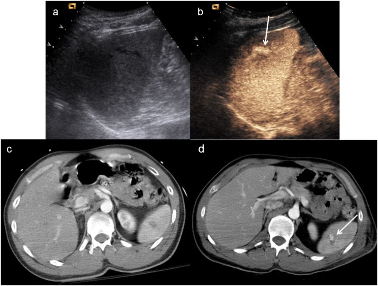 Figure 13.