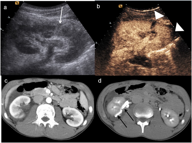 Figure 16.