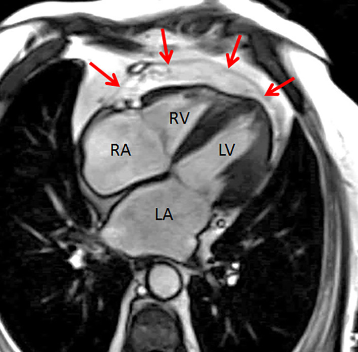 FIGURE 3