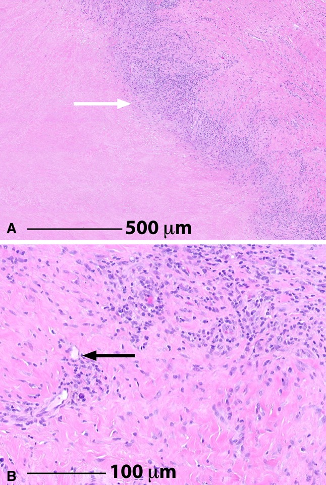 Fig. 3A–B