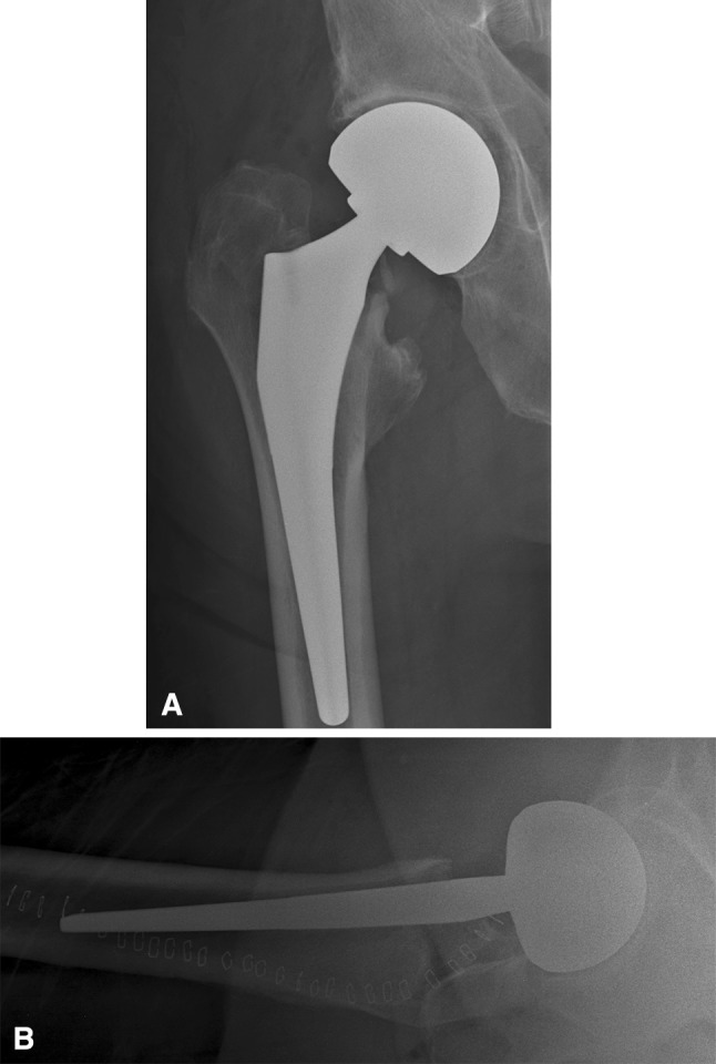 Fig. 1A–B