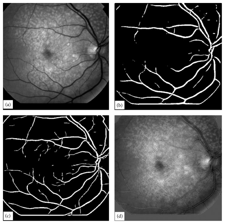 Figure 16