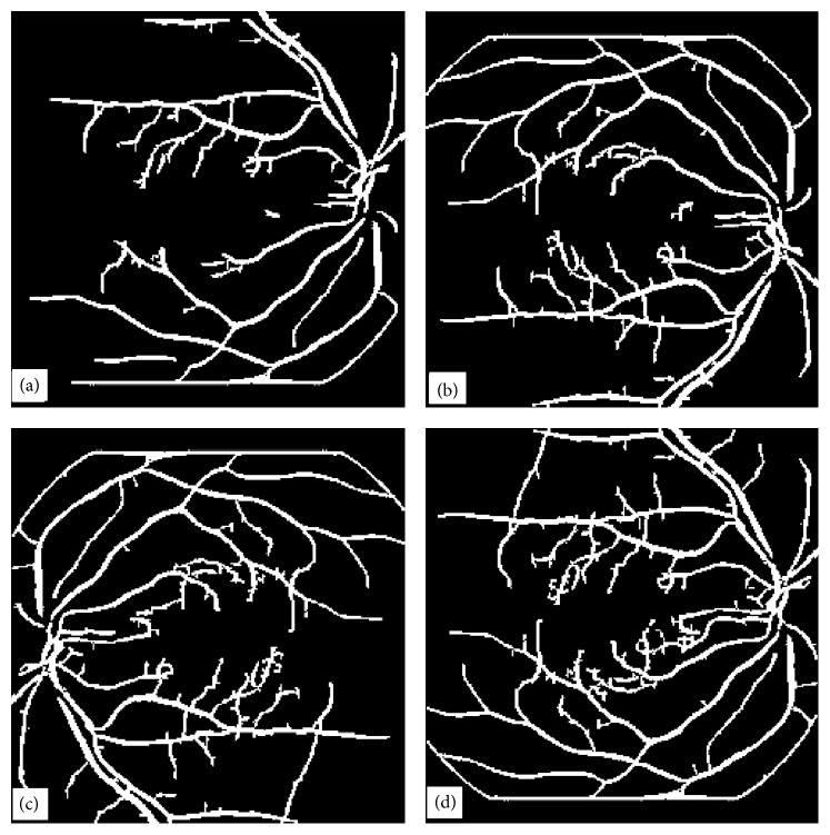 Figure 18