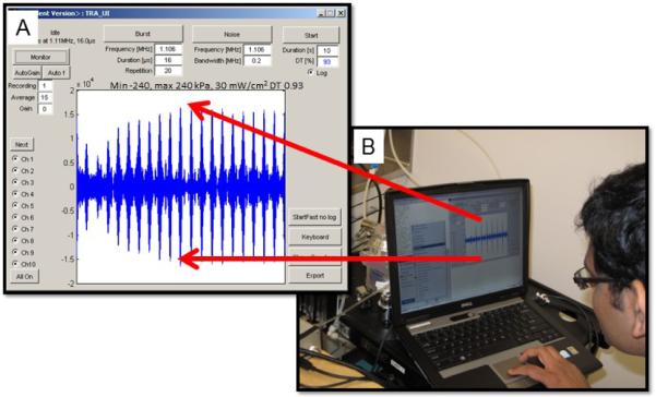 Figure 11